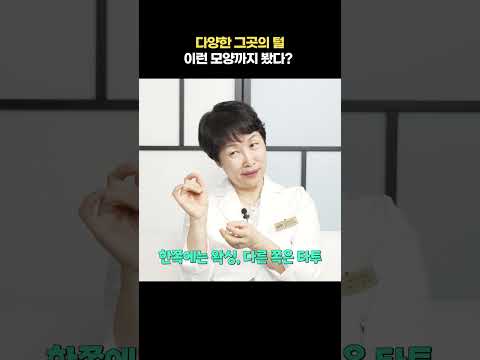 다양한 그곳의 털 이런 모양까지 봤다?