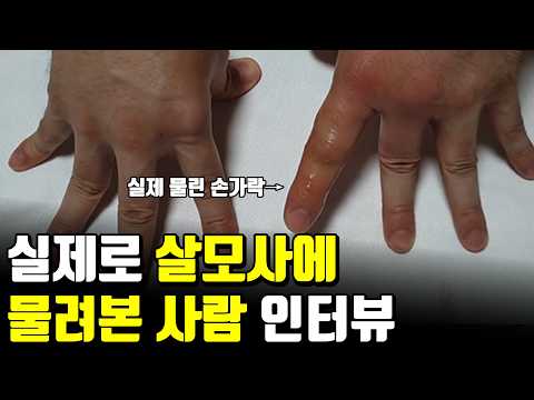 실제로 뱀에 물리면 생기는 일 (ft 살모사, 코브라) 2부 https://bbs.opparadise.com/data/apms/video/youtube/s3ybizNxjzE.jpg 실제로 뱀에 물리면 생기는 일 (ft 살모사, 코브라) 2부